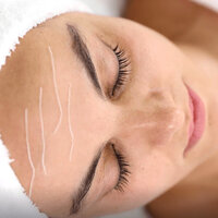 DS V-Line Collageen draden